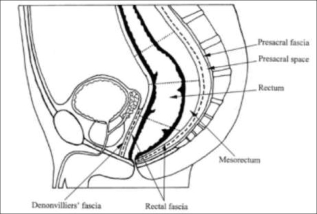 total mesorectal excision